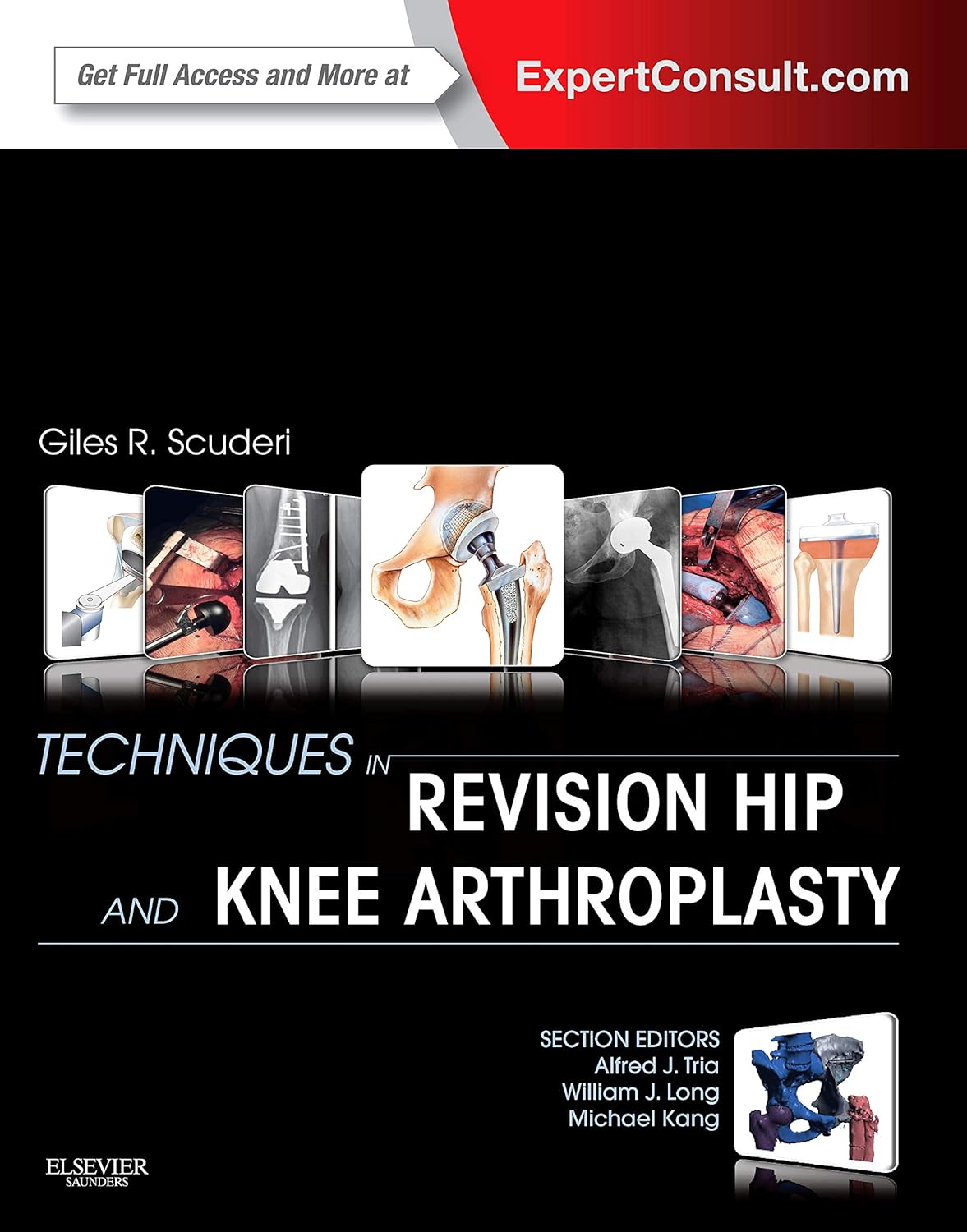 Techniques in Revision Hip and Knee Arthroplasty (ORIGINAL PDF from Publisher)