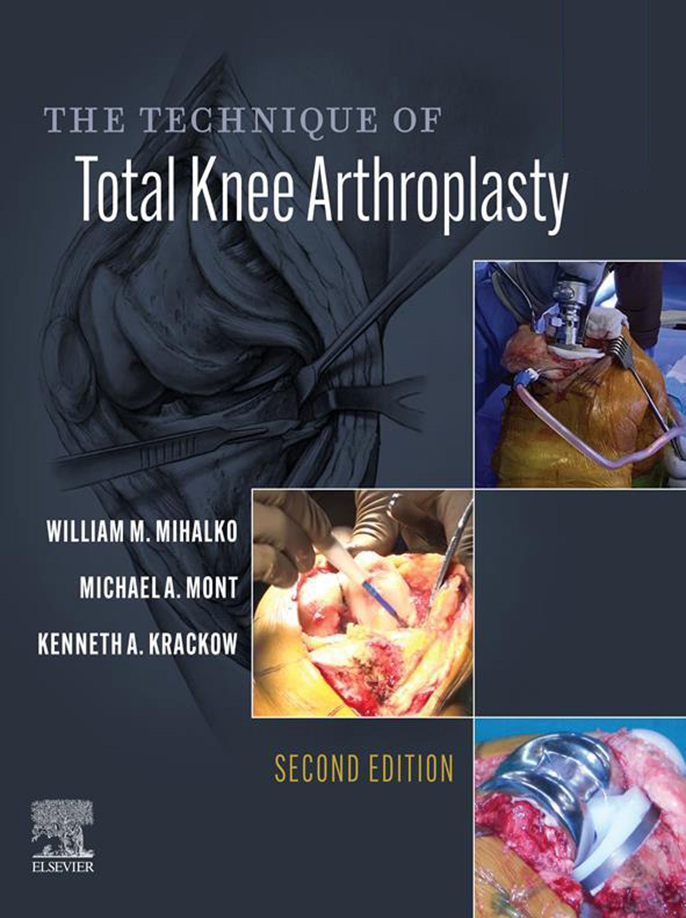 The Technique of Total Knee Arthroplasty, 2nd Edition