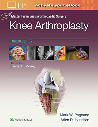 Master Techniques in Orthopedic Surgery: Knee Arthroplasty, 4th Edition