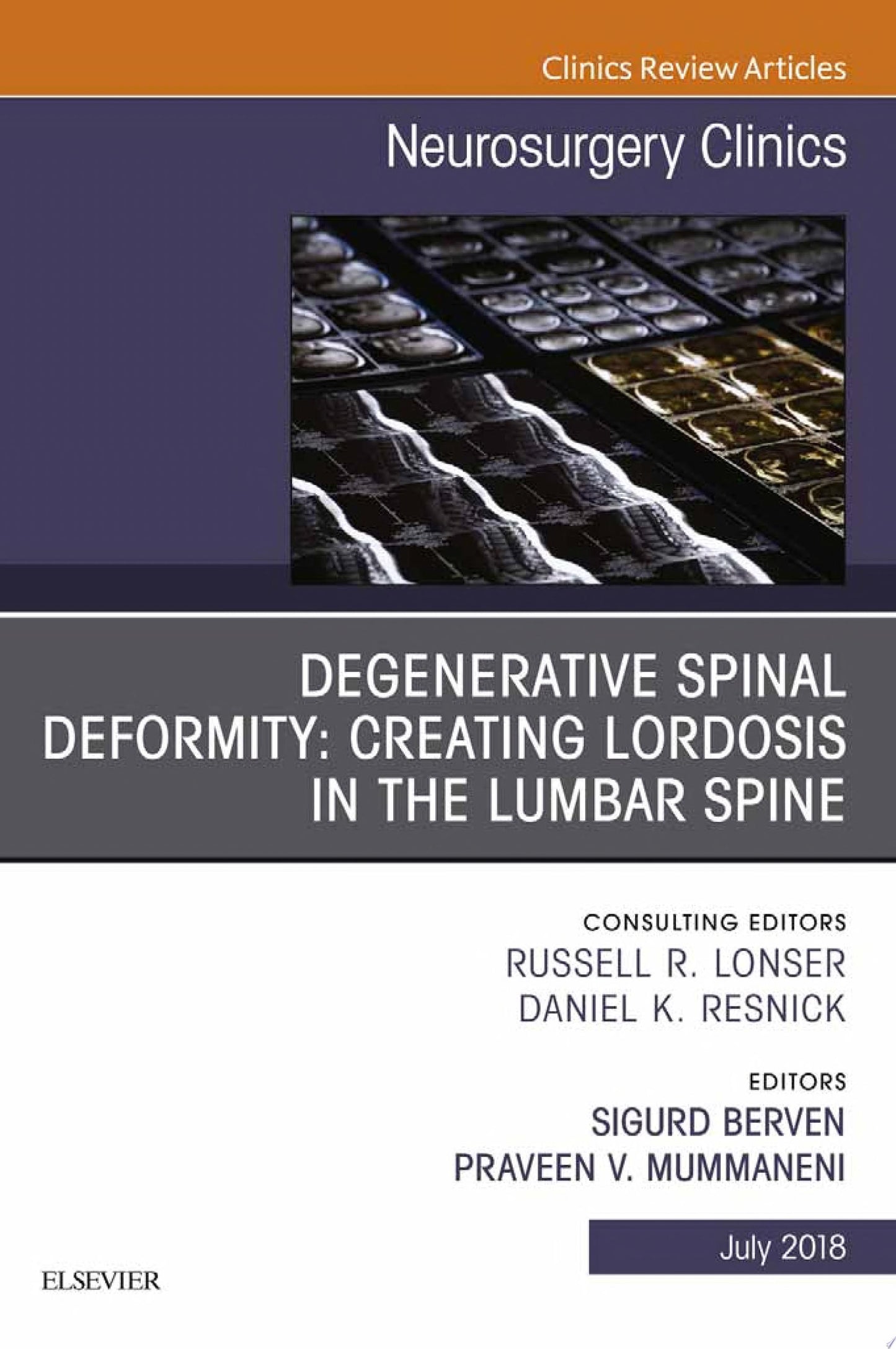 Degenerative Spinal Deformity: Creating Lordosis in the Lumbar Spine, An Issue of Neurosurgery Clinics of North America (Volume 29-3) (The Clinics: Surgery, Volume 29-3)