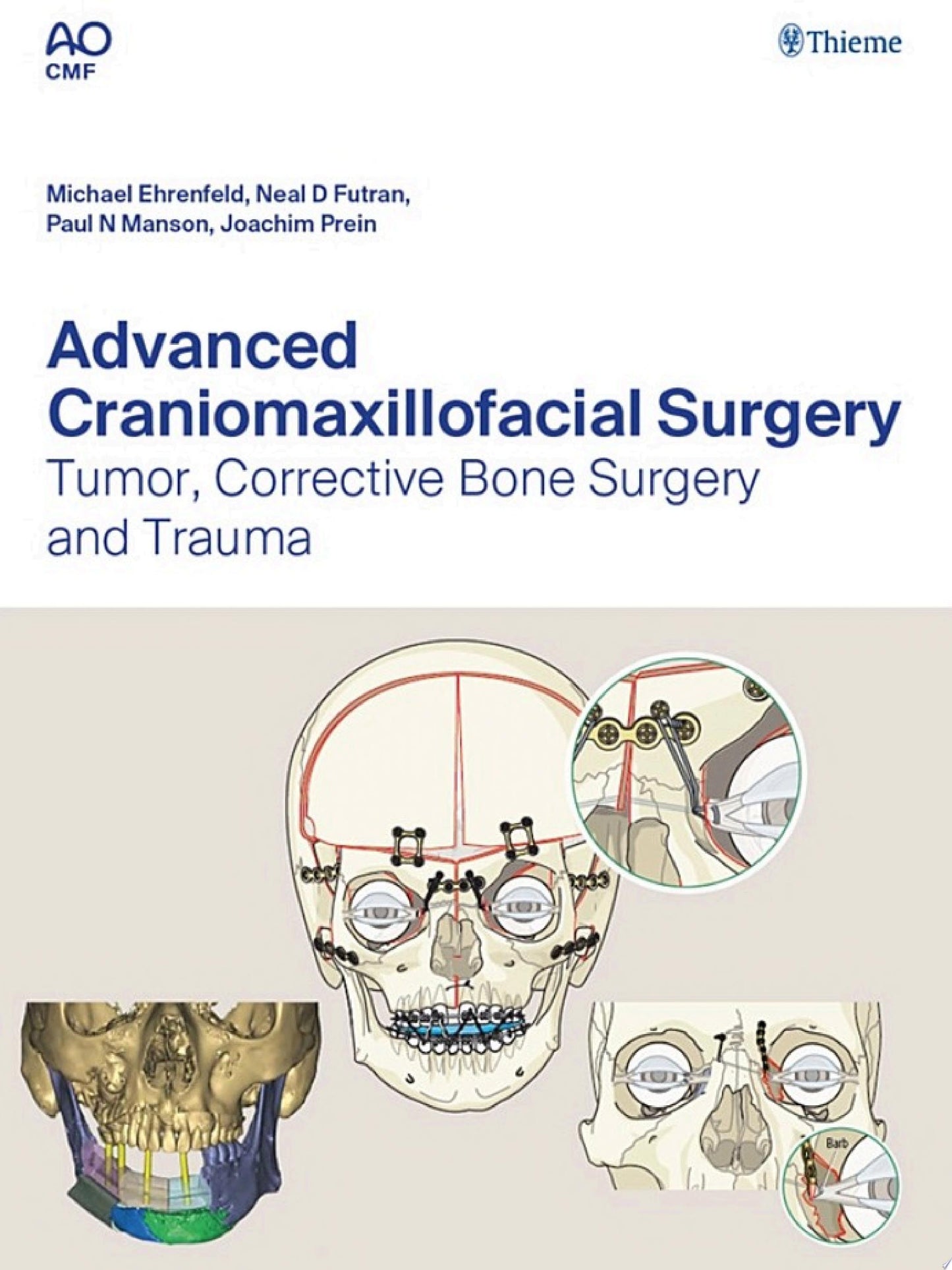 Advanced Craniomaxillofacial Surgery: Tumor, Corrective Bone Surgery, and Trauma
