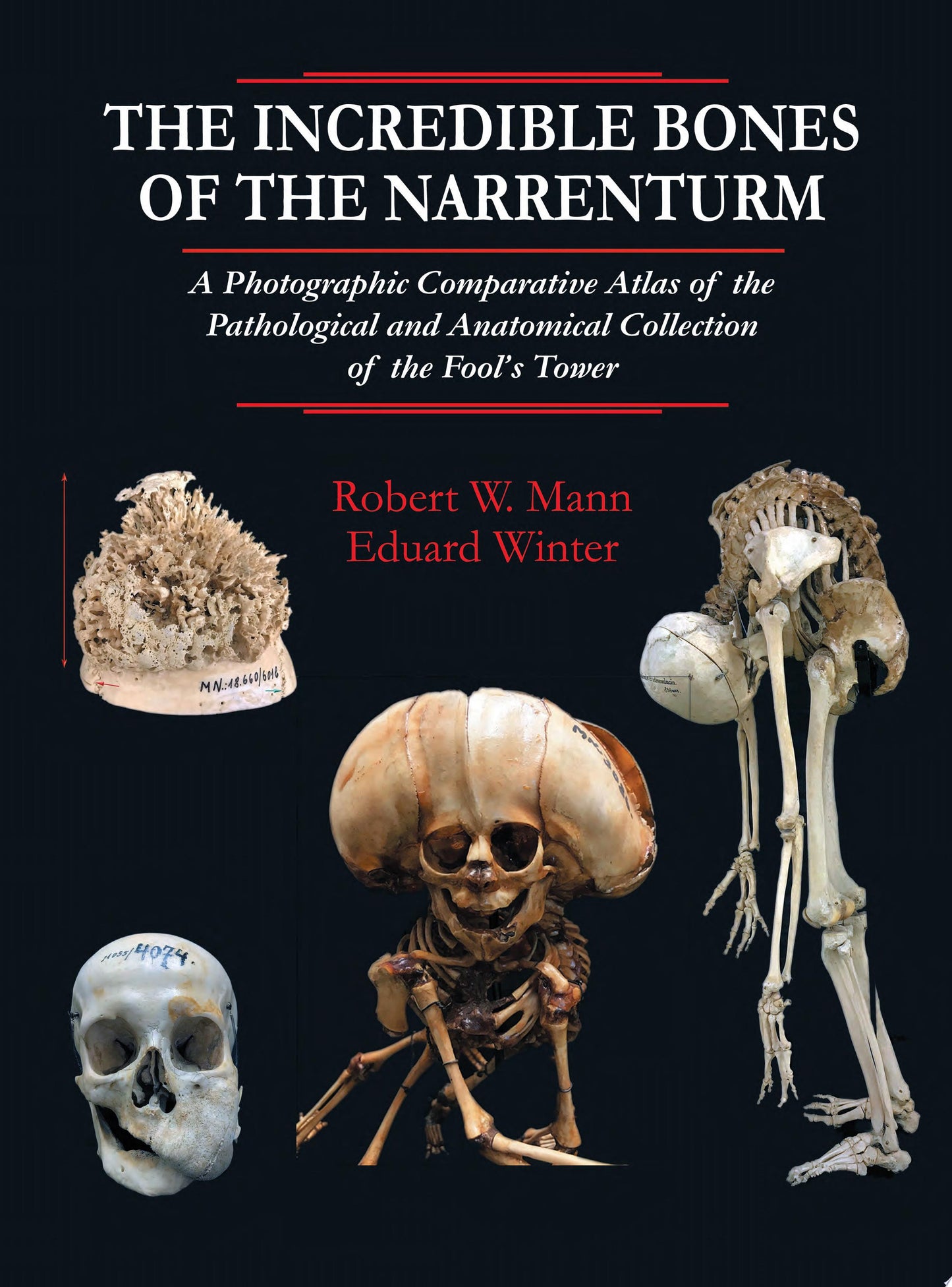 The Incredible Bones of the Narrenturm: Photographic Comparative Atlas of the Pathological and Anatomical Collection of the Fool's Tower