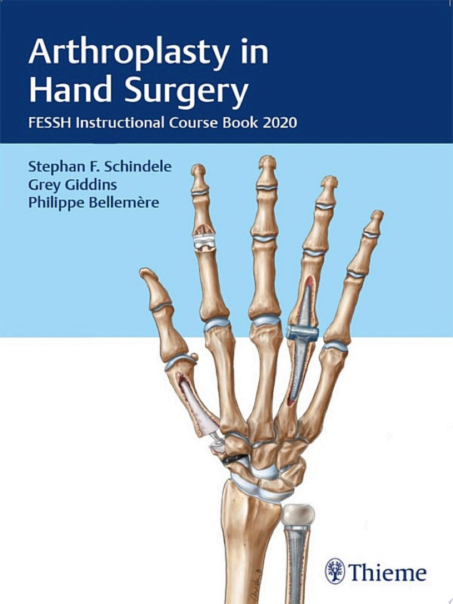Arthroplasty in Hand Surgery: Fessh Instructional Course Book 2020