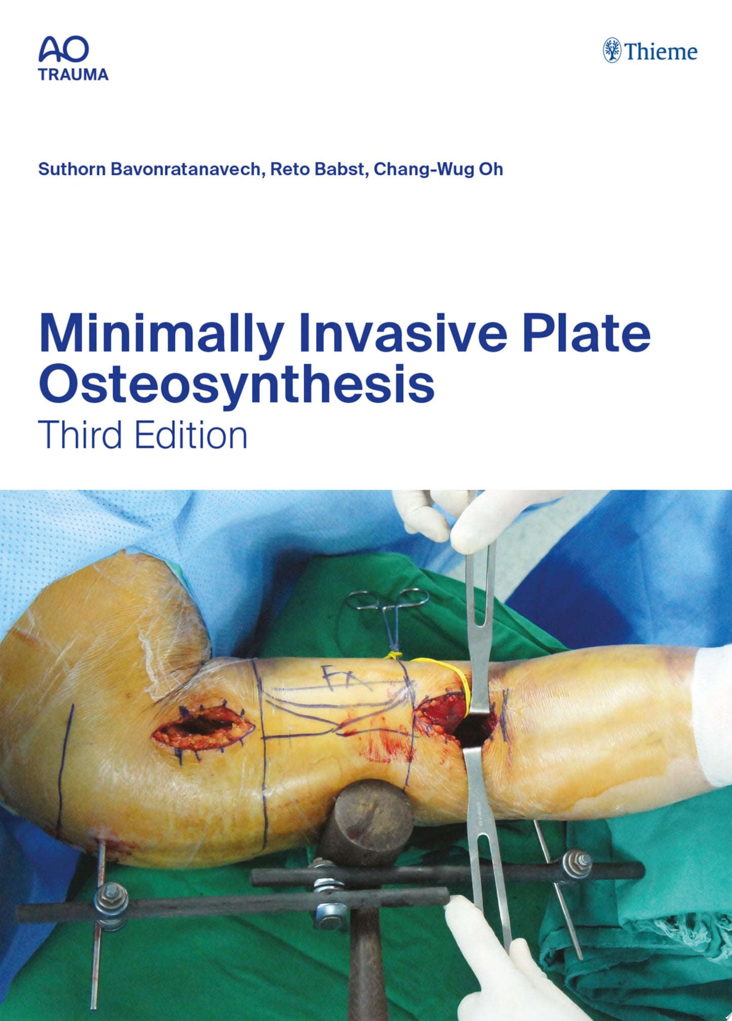 Minimally Invasive Plate Osteosynthesis (AO-Publishing), 3rd edition