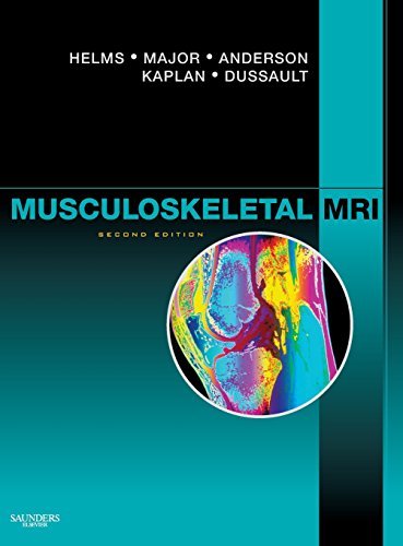 Musculoskeletal MRI, 2nd Edition