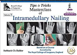 Tips & Tricks Masterclass Of Intramedullary Nailing (3 Volumes)