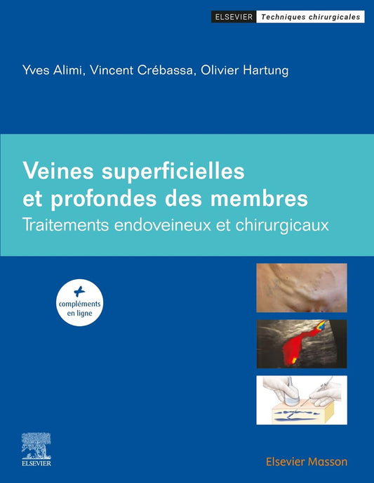 Veines superficielles et profondes des membres: Traitements endoveineux et chirurgicaux
