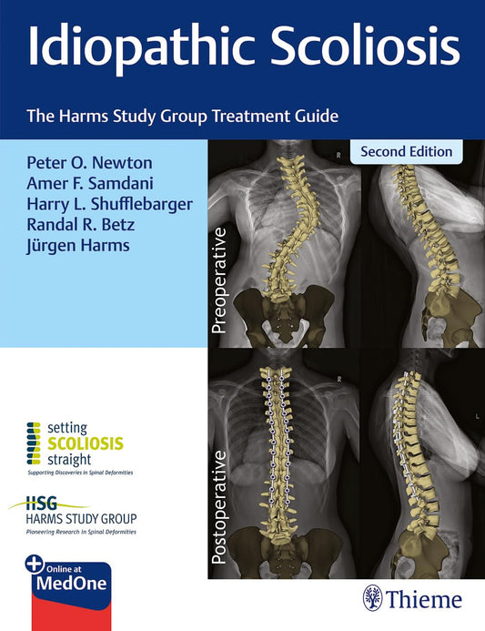 Idiopathic Scoliosis: The Harms Study Group Treatment Guide, 2nd edition