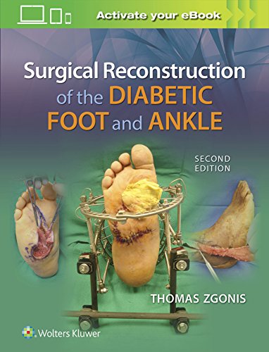 Surgical Reconstruction of the Diabetic Foot and Ankle, 2nd Edition