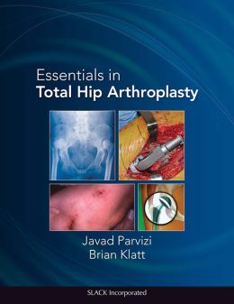Essentials in Total Hip Arthroplasty (ORIGINAL PDF from Publisher)
