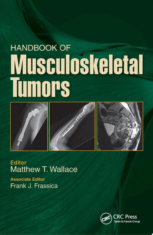 Handbook of Musculoskeletal Tumors
