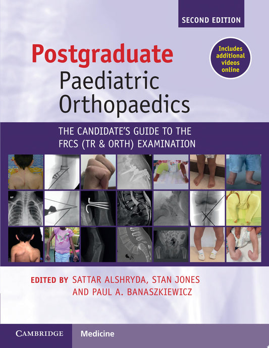 Postgraduate Paediatric Orthopaedics: The Candidate’s Guide to the FRCS (Tr and Orth) Examination (ORIGINAL PDF from Publisher)