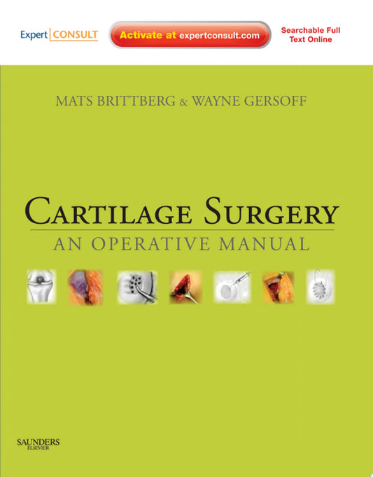 Cartilage Surgery: An Operative Manual