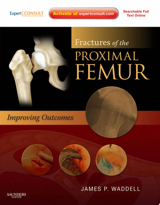 Fractures of the Proximal Femur: Improving Outcomes