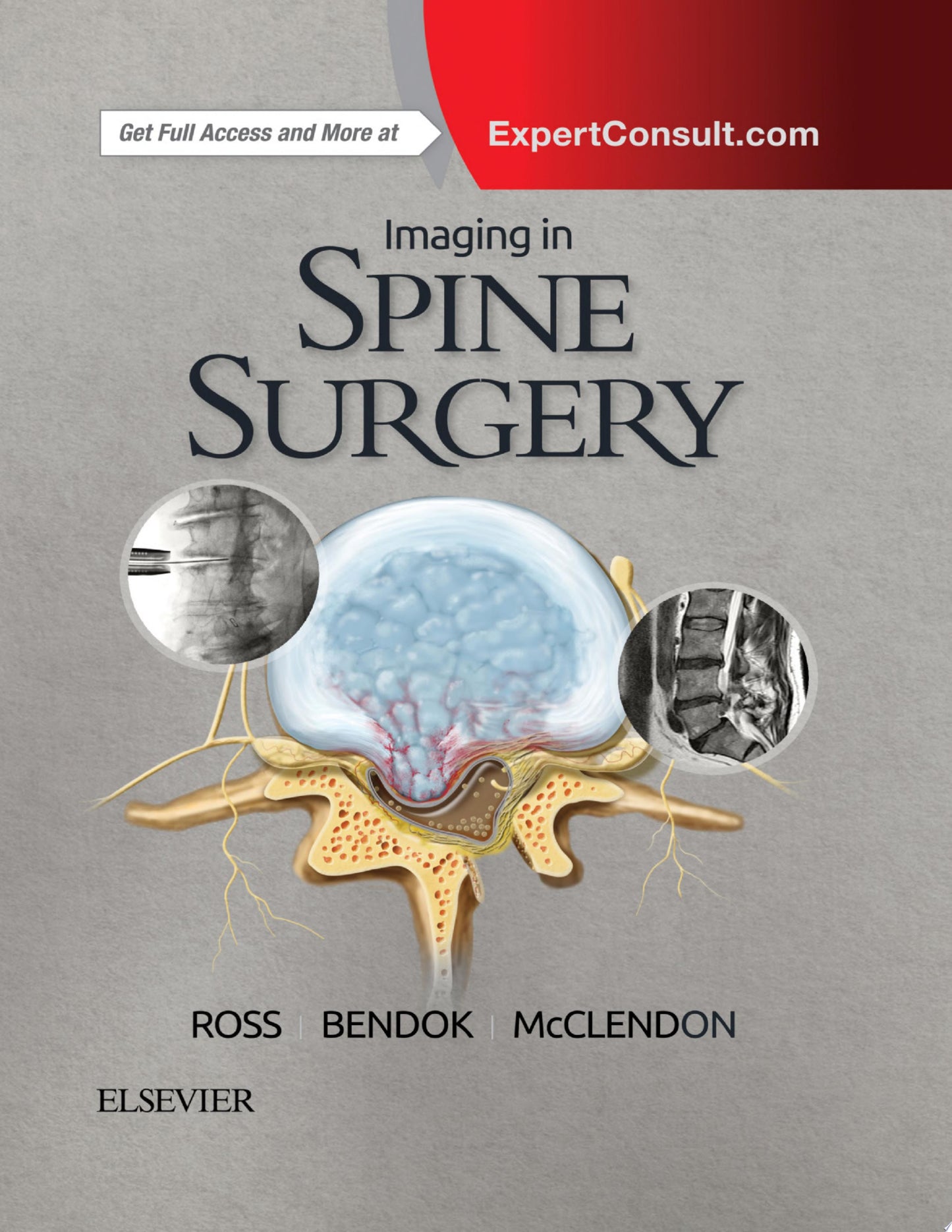 Imaging in Spine Surgery (Hot Topics) (ORIGINAL PDF from Publisher)