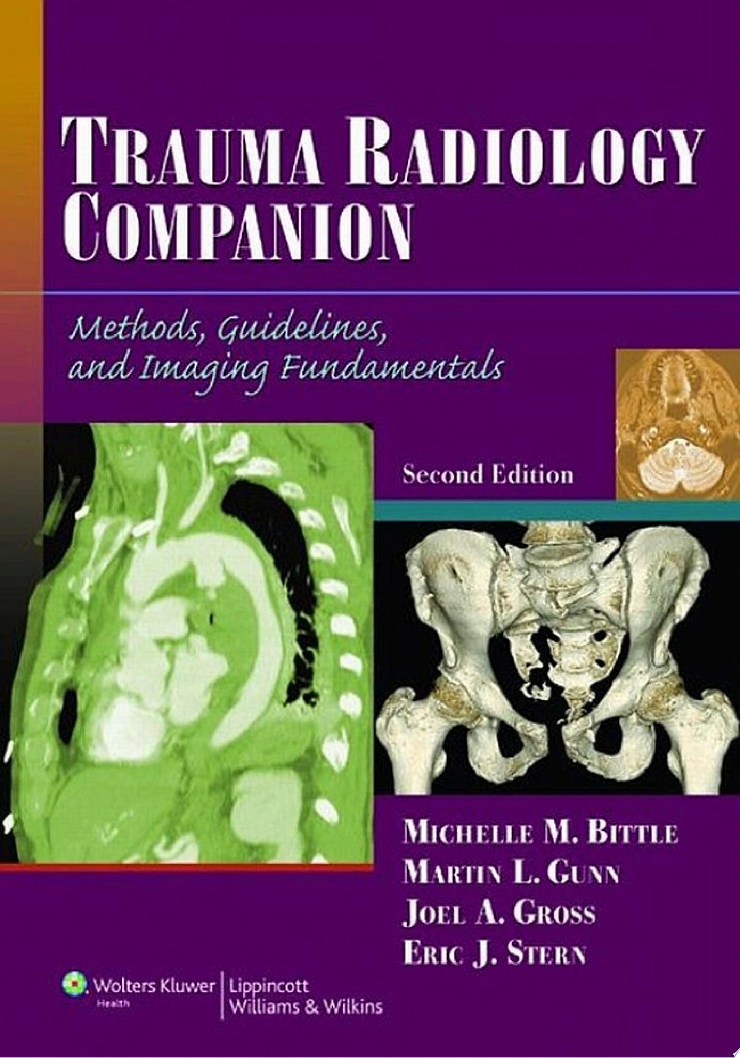 Trauma Radiology Companion: Methods, Guidelines, and Imaging Fundamentals                    / Edition 2