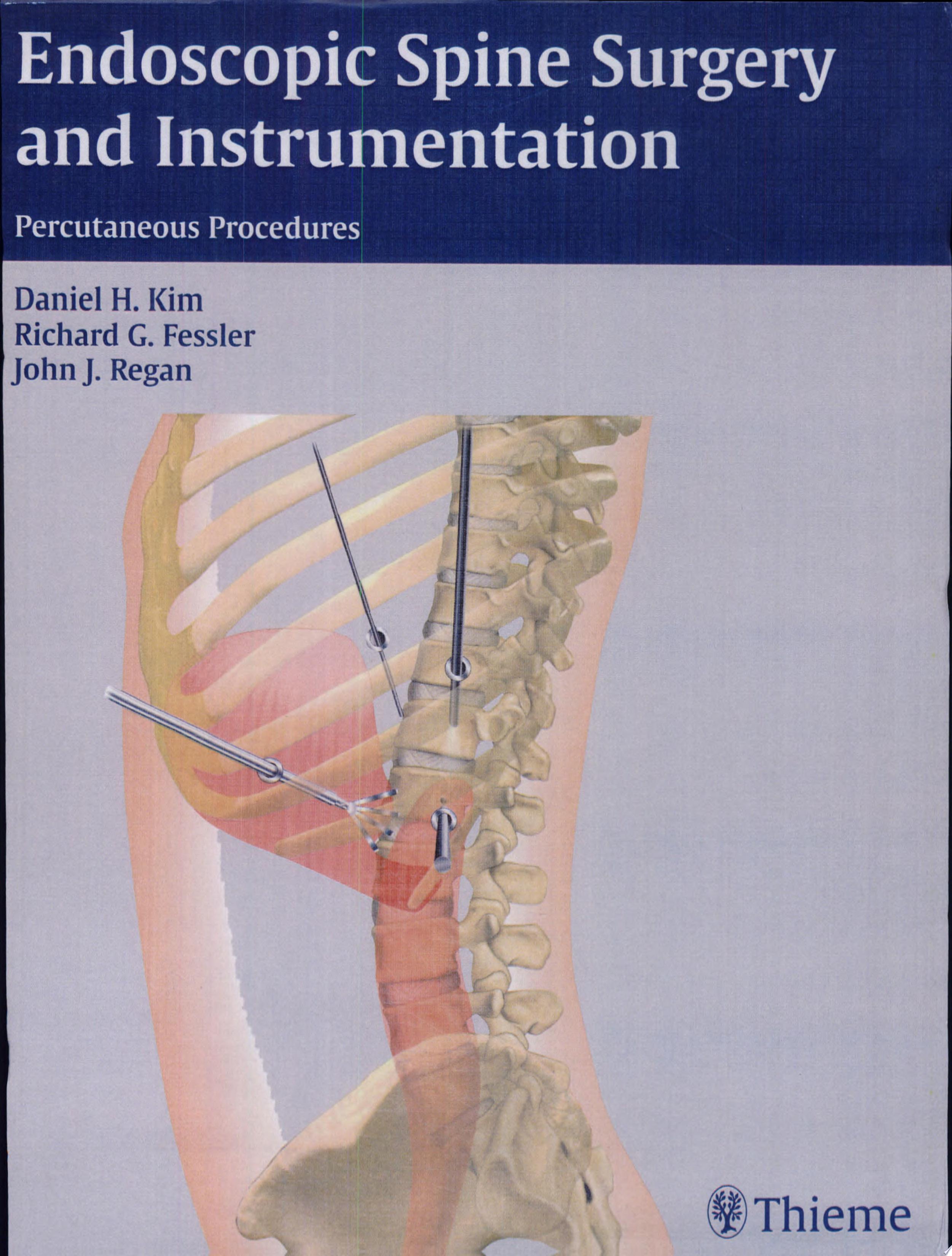 Spine Surgery – Orthopedics Library