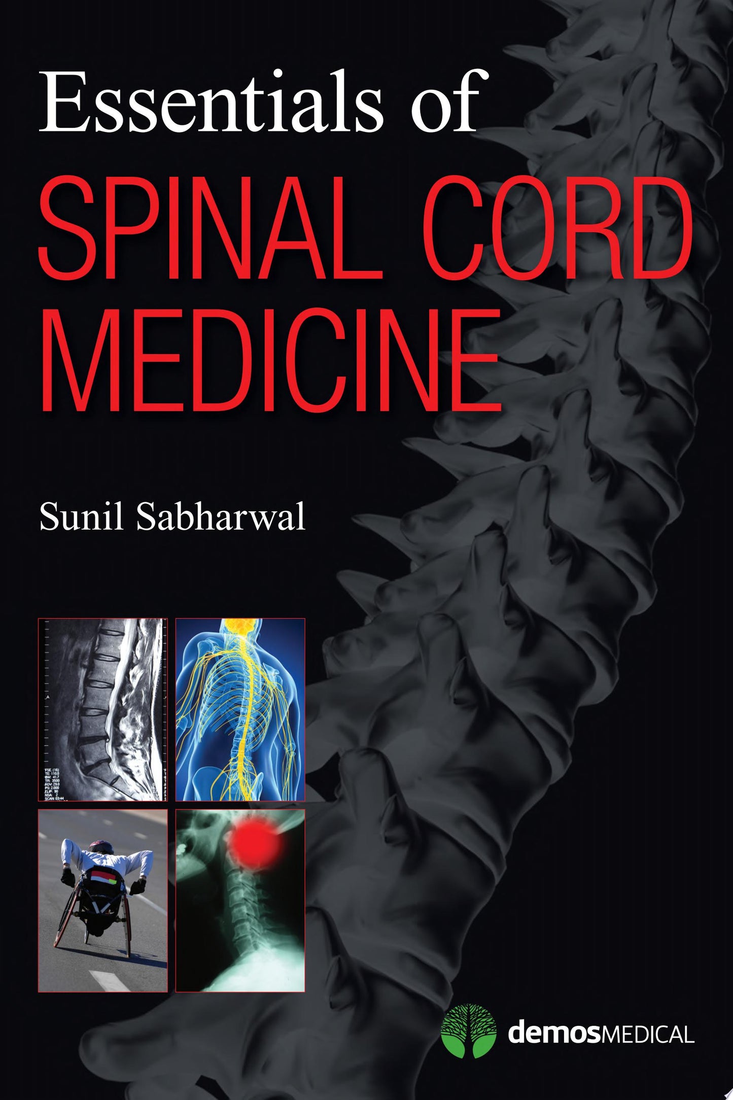 Essentials of Spinal Cord Medicine