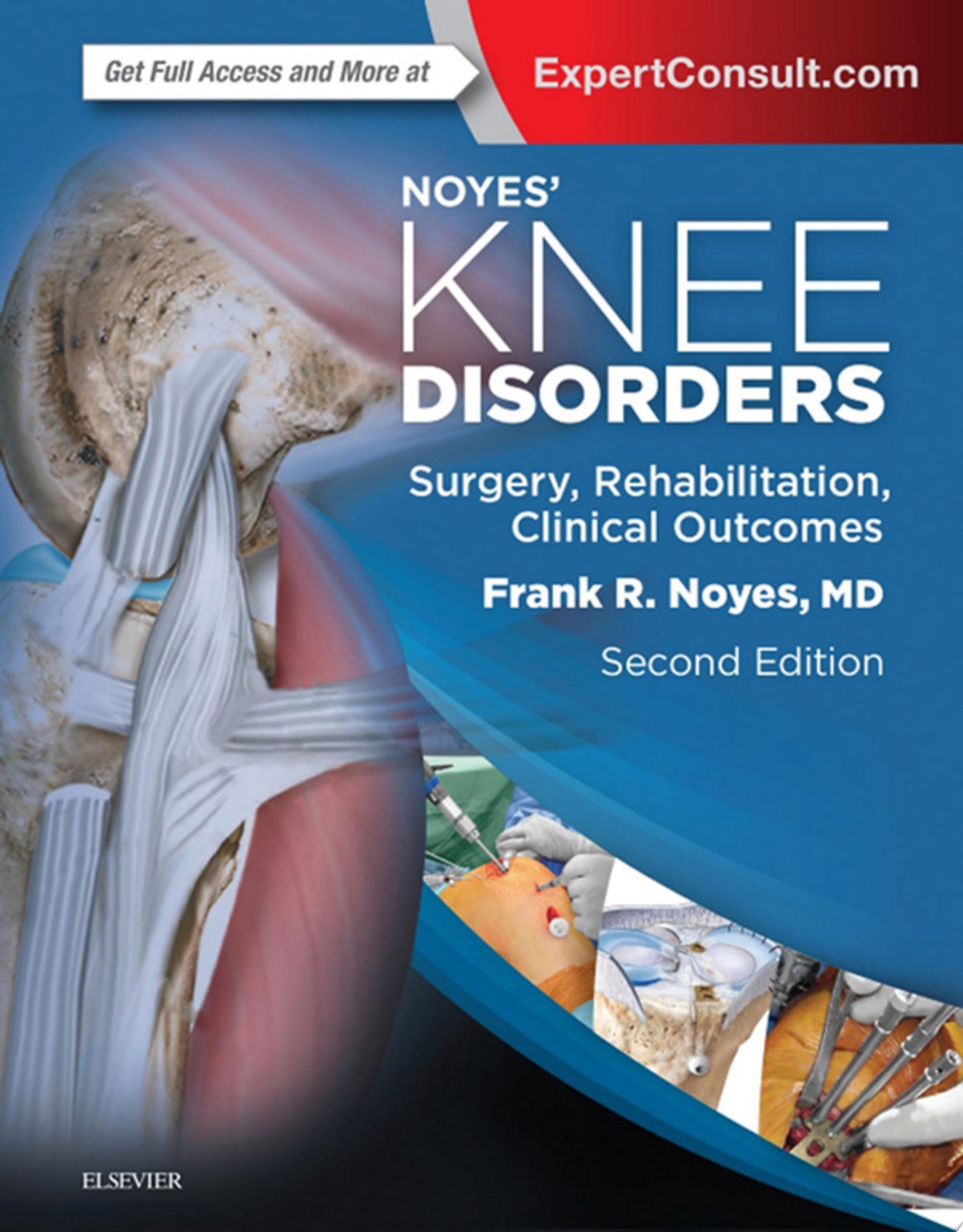 Noyes’ Knee Disorders: Surgery, Rehabilitation, Clinical Outcomes , 2nd Edition
