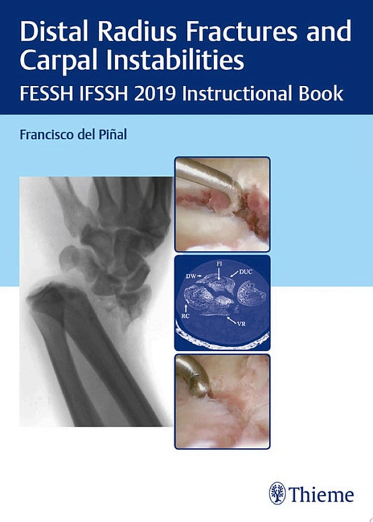 Distal Radius Fractures and Carpal Instabilities: FESSH IFSSH 2019 Instructional Book (PDF)