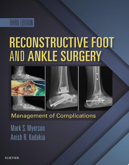 Reconstructive Foot and Ankle Surgery: Management of Complications, 3e (PDF)