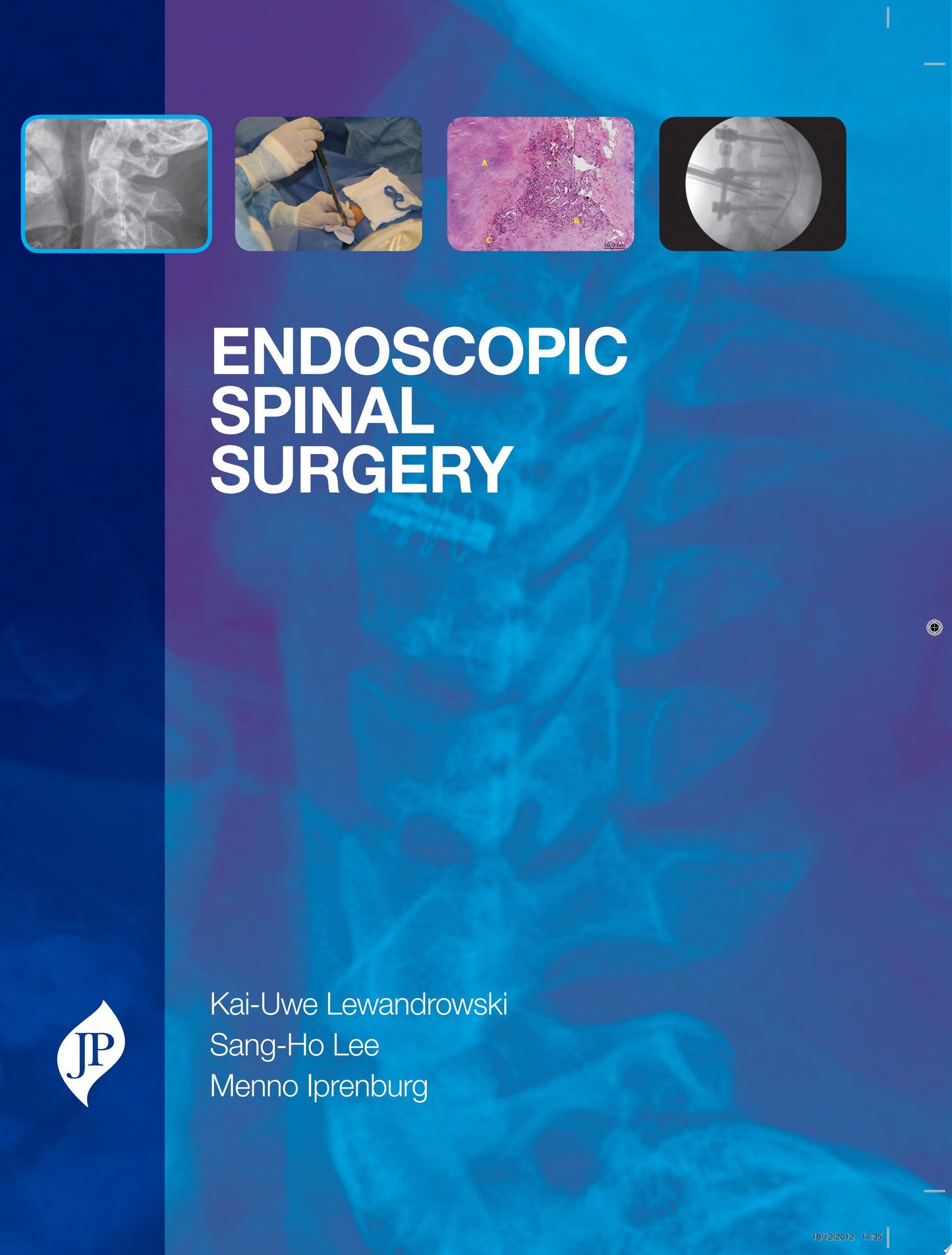 50 Landmark Papers Every Spine Surgeon Should Know (PDF)