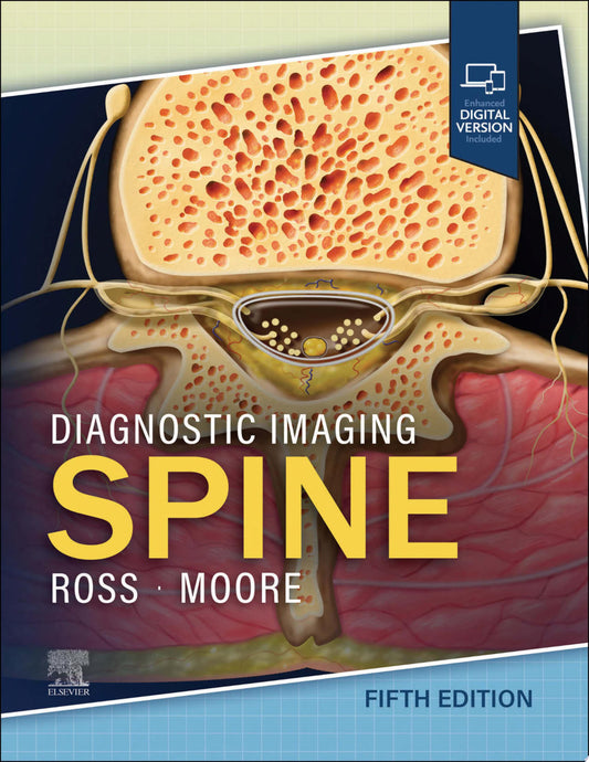 Diagnostic Imaging: Spine, 5th Edition
