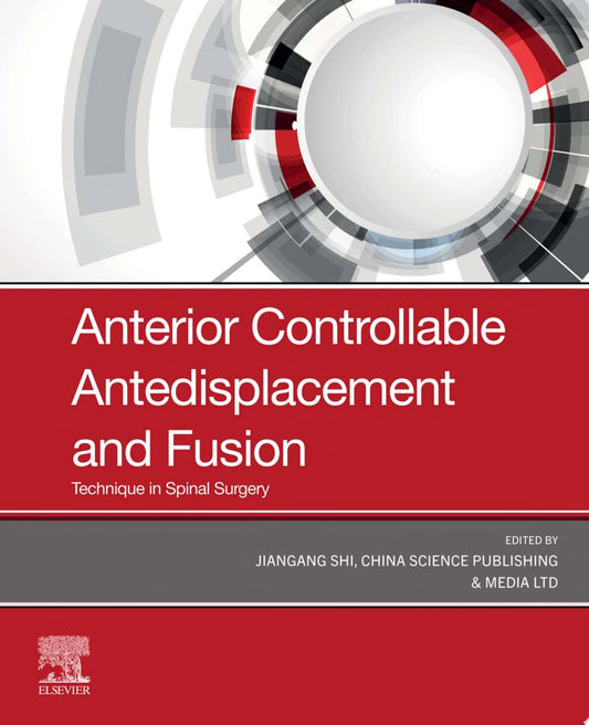 Anterior Controllable Antedisplacement and Fusion: Technique in Spinal Surgery